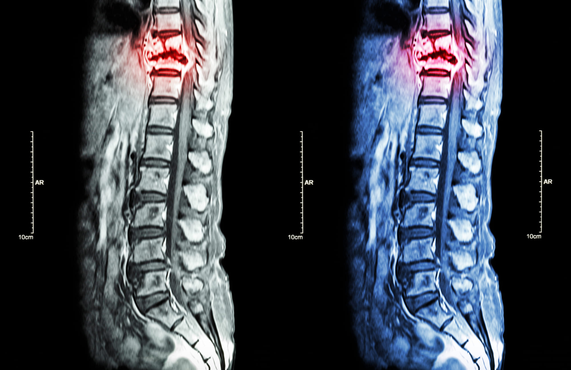 Depositphotos_96254384_L (1) spinal operation